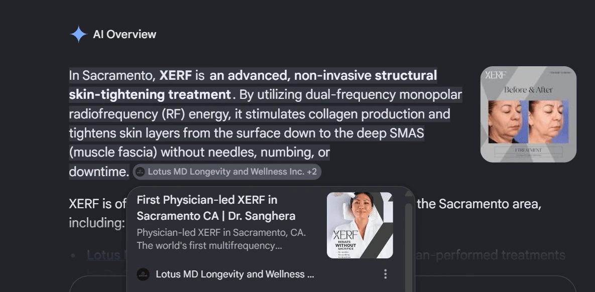 Google AI Overview explaining XERF in Sacramento and citing Lotus MD Longevity and Wellness as a source